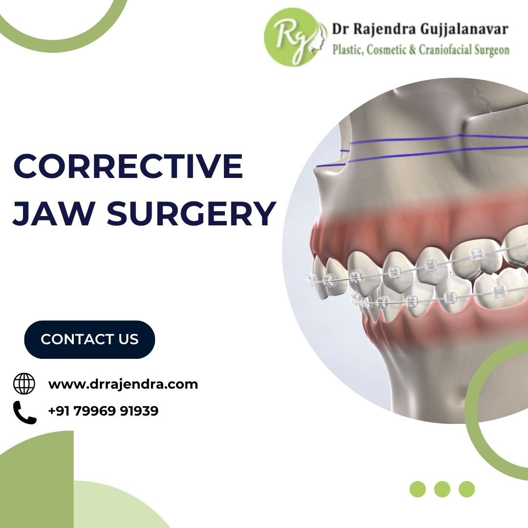 Orthognathic Surgery in Bangalore – Top Plastic Surgeon